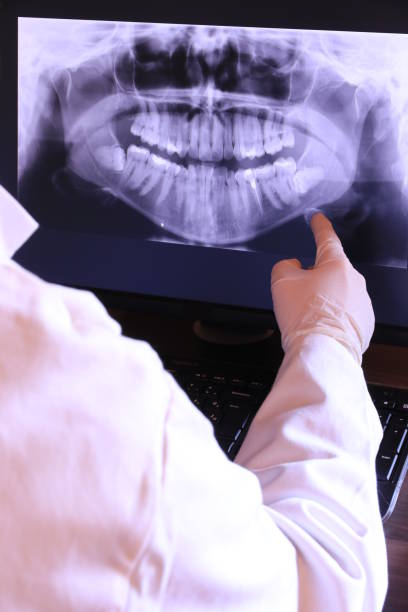 Best Emergency Dentist for Knocked-Out Tooth in Grain Valley, MO
