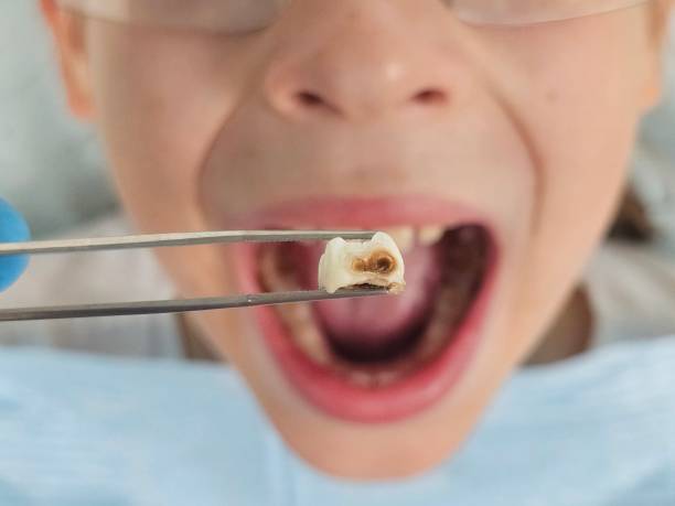 Best Urgent Dental Care for Toothache in Grain Valley, MO